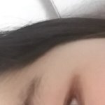 [조언부탁] 쌍수하면 이쁜눈될까?