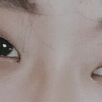 <b>미간</b>이넓어!눈성형ㄱ견ㄴ적좀