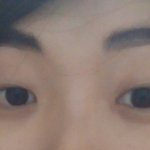 [꼭조언부탁] 쌍수하면 이뻐질까...짝짝이눈..