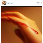 중2병은 역시 태연이지