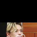 [세븐틴] <b>버논</b>입술 헤르페스아닐까