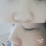 [댓글부탁해] <b>코가</b> 너무 못생겨서 스트레스야...