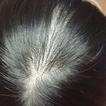 어제 <b>잡초</b>같은 머리 잘랐다가 탈모 걸린 것처럼 됐다는 쓰닌데