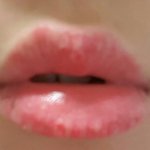 [댓글부탁해] (<b>사진o</b> 약혐..)입술상태가 심각해