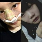 프로듀스 101 <b>정채</b>연 성형?
