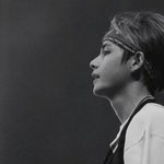 [방탄소년단] 태형이<b>이마</b>걱정하는아미들많은데