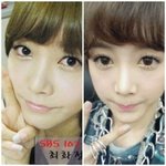 렌즈 끼기 전 후 <b>차이</b> 심한 <b>사람</b>ㅜㅜㅜ