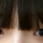 [댓글부탁해] 쌍수하는게 나을까??