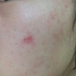 [드루와] !!+정보추가!!!이정도면피부좋아진거맞지??