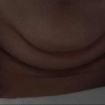 여자들 <b>턱살</b> 접히는거 보면 한심;;