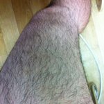 [댓글부탁해] <b>다리털</b>이 너무많아서 고민입니다