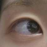 얘들아어떡해 나오늘갑자기 다크<b>서클</b>이 엄청심해졌어