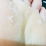 [개개개극혐] <b>사진</b>)얘들아 <b>발</b>에 이거뭐야??