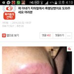 [개깊은빡침] 원글보존 제아내가지하철에서 <b>폭행</b>당했어요