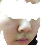 [드루와] 볼블랙<b>헤드</b>,코블랙<b>헤드</b>,모공없애는법 !