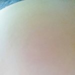 오 나 <b>피부</b> <b>개</b>좋은듯?(사진ㅇ)