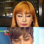 [EXO] 카이 쌍수 부작용 심한듯