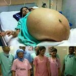 [유머판] 파키스탄의 11<b>쌍둥이</b>