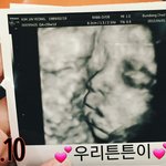 [댓글부탁해] +주작아니야우리<b>튼튼</b>이맞아)나 임신했어 글쓰니인데