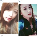 [모든팬덤] 하니<b>턱</b>끝<b>필러</b> 빼박아님?