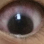 [EXO] 콘텍트렌즈 충혈 어떡해...?