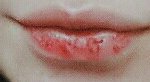 드디어 보들보들한 입술 갖게됨 ㅠㅠ!!