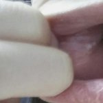 [댓글부탁해] <b>입안</b>에 난거 뭔지 아는사람(약혐)
