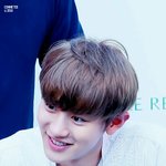 [EXO] 아토피 있는사람?