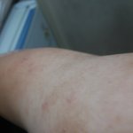 [조언부탁] 고시<b>텔</b>에 생긴 벌레문제 제 책임인가요? -- 2번째