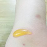 [드루와] 술먹고다음날보니까무릎에엄지만한<b>물집</b>잡힘