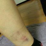 [꼭조언부탁] 엄마를 때리는 아빠