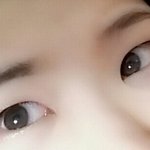 무쌍인데 쌍수해야됄가?
