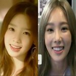 [방탄소년단] 태연 <b>쌍수</b> 빼박