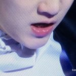 [방탄소년단] 윤기<b>아랫니</b>