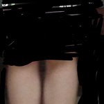 [ㅠㅠ조언좀] 다리알ㅠㅜ(사진