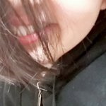 [드루와] 나 <b>앞니</b> 겁나 큼