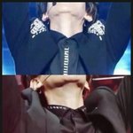 [EXO] 백현 턱 <b>양악</b>하고 부작용생긴거야?