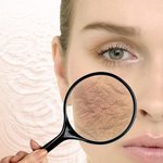 건조한 피부 플라즈마로 보습효과 톡톡히 받기 :)