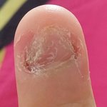 [댓글부탁해] 진<b>짜개</b>극혐) 나 같은 손톱 있음?