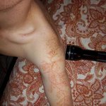 [EXO] <b>번개</b> 맞으면 피부에 이런거 생김ㅇㅇ