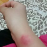 얘들아 도와줘.. 키스<b>마크</b>???? 그거