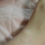 [댓글부탁해] 원래 <b>메탈</b>시계차면 자국이렇게 심해?