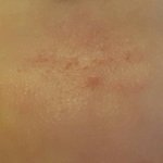 [극혐주의] 턱에 나는거 어떻게 없애요??