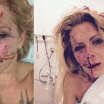 [<b>망국</b>다문화] 폭행당한 덴마크 커플. 이민청 설립이 가시화되면 이는...