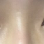 [댓글부탁해] 쌍수잘됐다는 기준이 뭐야? 나 정도면 잘된건가