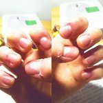[조언부탁해] 내 최고 <b>콤</b>플랙스는 ㅅㅂ 손톱