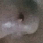 [약혐] 코에 <b>왕여드름</b> 났어...