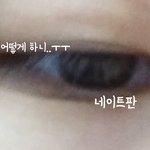 [조언부탁해] 눈 이렇게 생겼는데 <b>쌍액</b> 어떻게해??