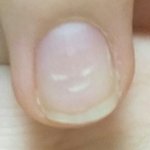 [드루와] 내 손톱 <b>화남</b>ㅋㅋㅋㅋㅋㅋㅋㅋㅋㅋㅋㅋㅋ