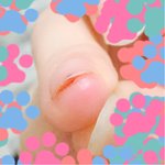 [사진있음] 이거 병원<b>가야</b>해??